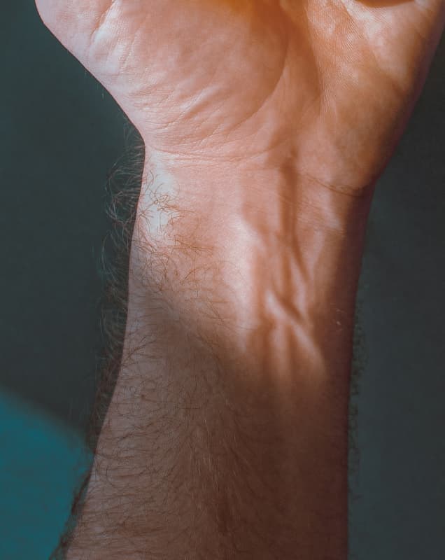 Wrist orthopaedic treatment